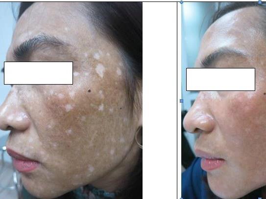 HÚ HỒN LÀM ĐẸP ĐÓN TẾT: da phát sáng như người ngoài hành tinh sau khi tắm trắng-7