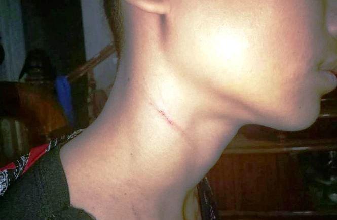 Hiệu trưởng bị tố bóp cổ học sinh: Tôi chỉ kéo cổ áo-1