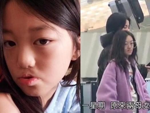 Con gái Lý Á Bằng - Vương Phi xuất hiện với diện mạo bất ngờ sau ca phẫu thuật hở hàm ếch