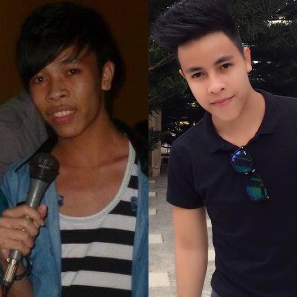 Bị bồ đá vì xấu, 2 chàng Tiền Giang, Đồng Tháp xây lại mặt đẹp như tài tử-5