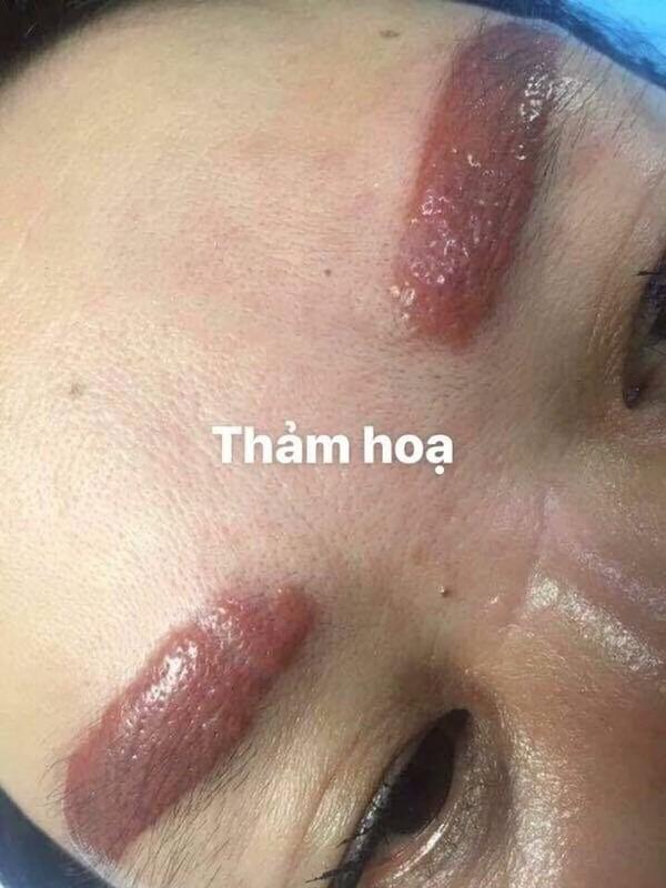ĐỠ KHÔNG NỔI với những ca thảm họa xăm lông mày tiền mất tật mang-1