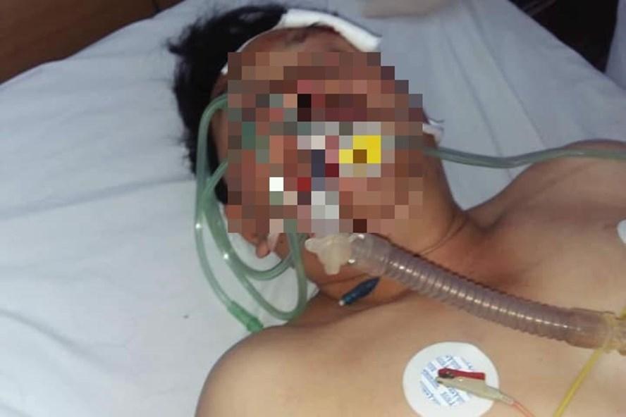 Nhận nợ thua độ cho người thân, bị xã hội đen đánh chết-1