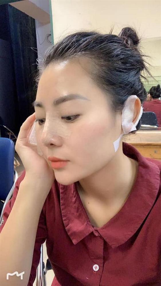 Lan Cave gây sốc khi lộ ảnh phẫu thuật đứng chung hàng ngũ chị em mặt rắn-4