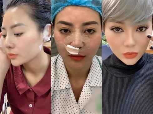 Lan 'Cave' gây sốc khi lộ ảnh phẫu thuật đứng chung hàng ngũ 'chị em mặt rắn'