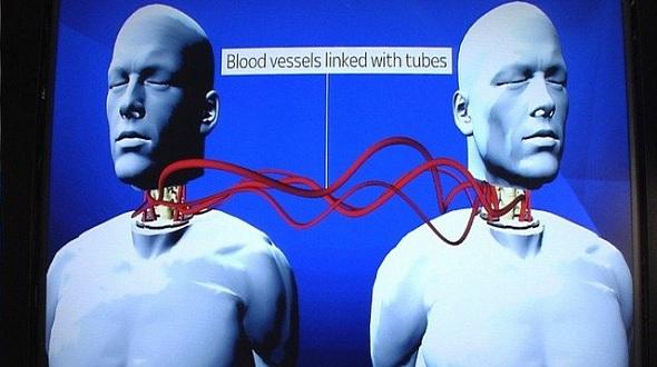 Thí nghiệm kỳ dị ghép đầu chó của nhà khoa học Liên Xô-3