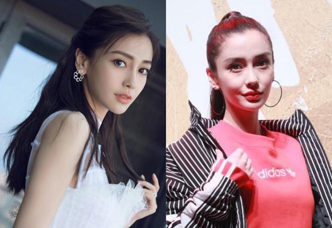 Angelababy trông khác lạ, bị nghi lạm dụng phẫu thuật thẩm mỹ-2