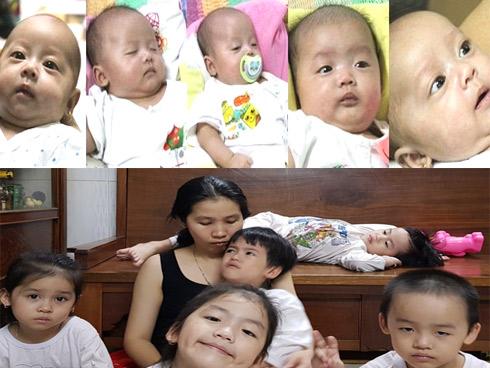 Bất ngờ trước ngoại hình sau 6 năm của 5 đứa trẻ trong ca sinh 5 duy nhất ở Việt Nam