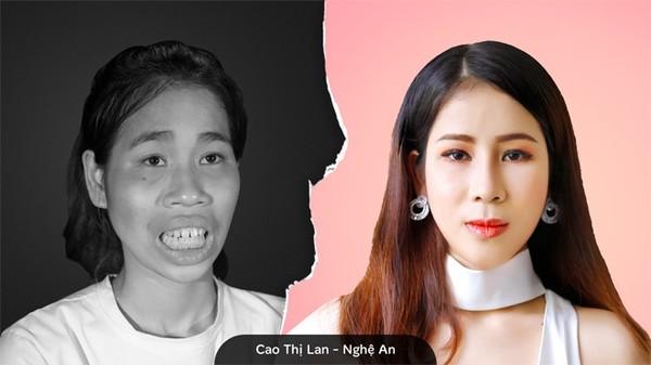 Cuộc sống mới của cô gái bị mẹ câm điếc xua đuổi sau phẫu thuật thẩm mỹ: Mình chưa nghĩ đến việc sẽ yêu ai đó-3