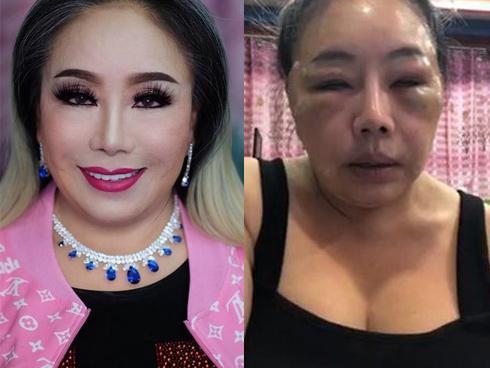 Đại gia tuyển chồng yêu 28 lần/ngày quấy rối sao nam bằng tuổi cháu-7