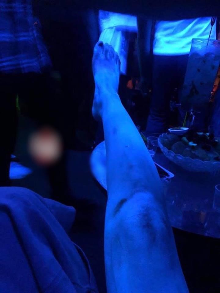 HÚ HỒN LÀM ĐẸP ĐÓN TẾT: da phát sáng như người ngoài hành tinh sau khi tắm trắng-3