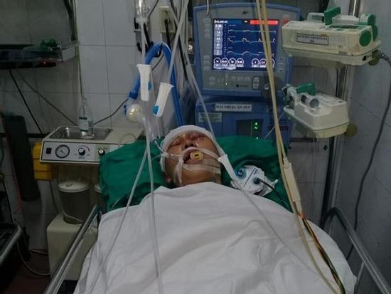 Nam sinh 17 tuổi bị nhóm đối tượng đánh chấn thương sọ não, hôn mê bất tỉnh