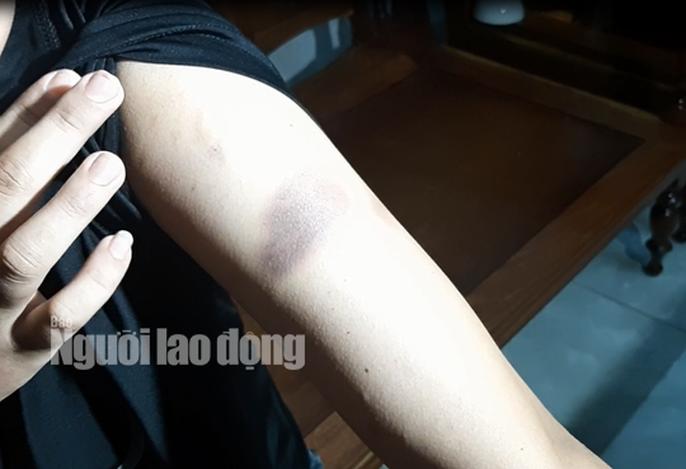 Thiếu nữ bị ông trùm điều đào tra tấn dã man-3