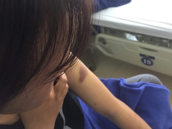 Thêm 1 vụ tra tấn dã man như thời trung cổ: Ông trùm chuyên điều đào dùng kéo hành hạ nhân viên suốt 2 ngày trời-3