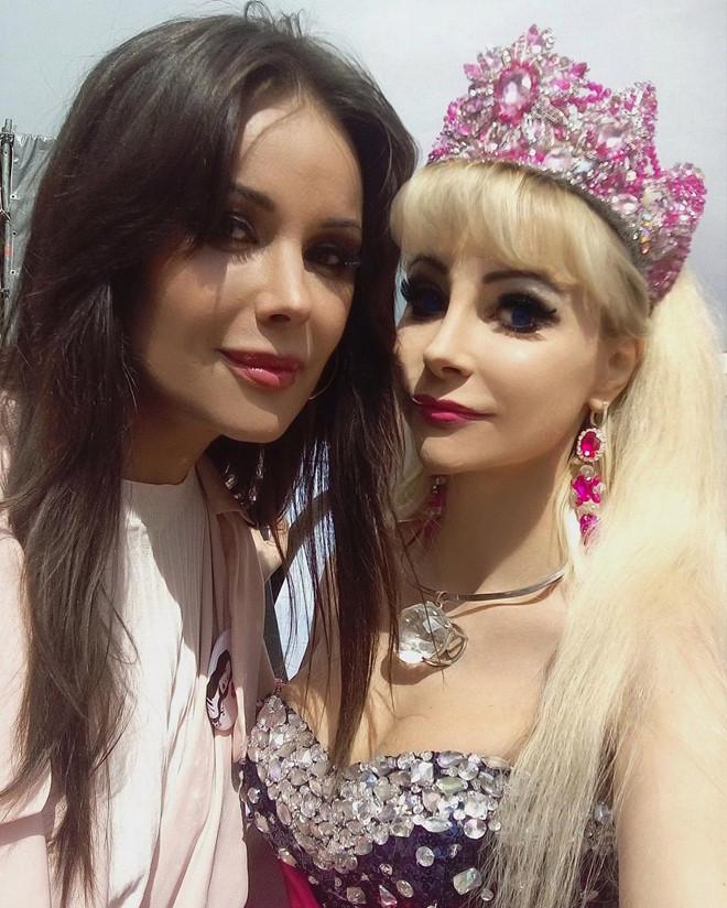 Đối thủ của Ngân Anh gây chú ý vì mặt cứng đờ như búp bê-5