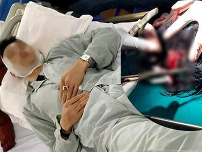 Sau va chạm giao thông, tài xế xe Mazda 3 bị chém toác đầu