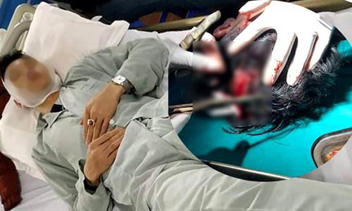 Sau va chạm giao thông, tài xế xe Mazda 3 bị chém toác đầu-1