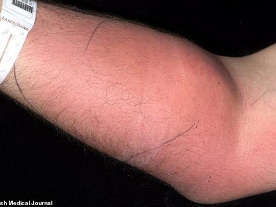 Người phụ nữ suýt mất mạng vì chạm vào tinh trùng của bạn trai-3