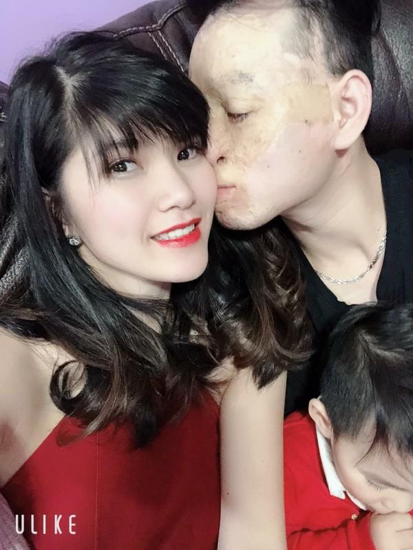 Cặp đôi vợ xinh, chồng xấu đã chứng minh tình yêu thực sự trước lời miệt thị của dân mạng 5 năm về trước-2