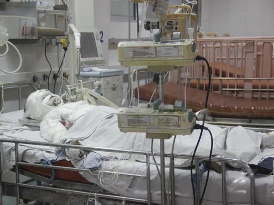 Bố hút thuốc bén lửa vào bình gas, con gái 10 tuổi bỏng nặng