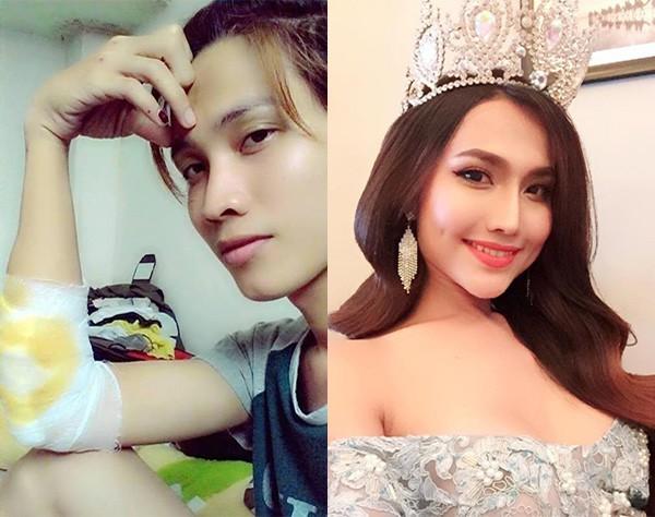 Bùi Đình Hoài Sa tên thật là Bùi Văn Sơn, sinh năm 1991 tại An Giang. Năm 2015, Hoài Sa được nhiều người biết đến khi đăng ký đi thi Vietnam Idol. Dừng chân khá sớm nhưng Hoài Sa sau đó đã đổi đời khi tiêm hormone nữ để dần chuyển đổi giới tính, tham dự cuộc thi dành cho người đẹp chuyển giới "Miss Beauty 2015". Cô đã trở thành Hoa hậu chuyển giới đầu tiên của Việt Nam.