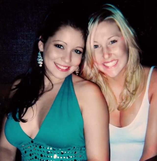 Ngực co lại, cứng ngắc như đá sau phẫu thuật thẩm mỹ khiến cô gái khóc ròng-1