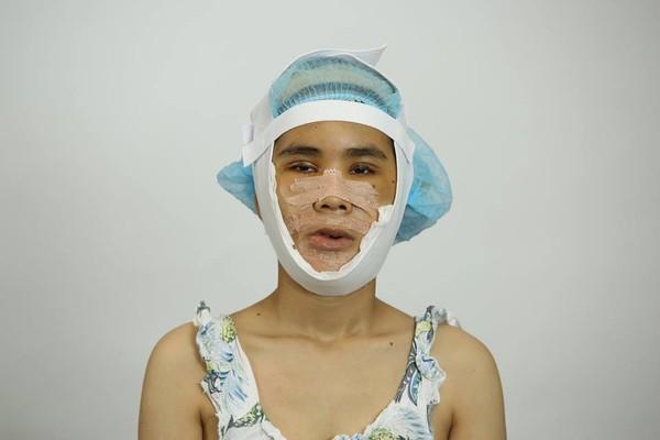 Top 3 cuộc phẫu thuật thẩm mỹ đổi đời gây xôn xao mạng xã hội năm 2018-2