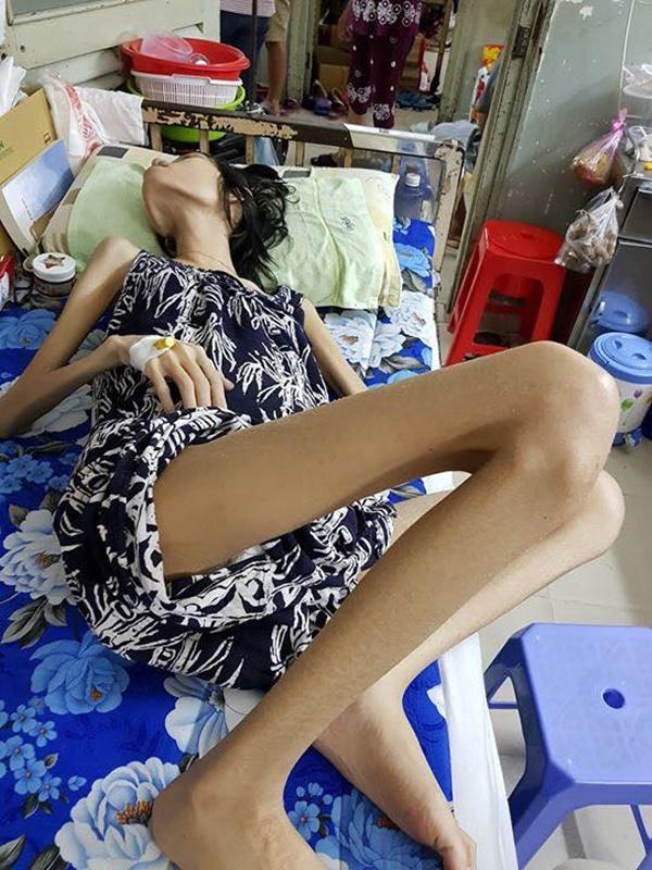 Sức khỏe mẫu Việt 9x ung thư buồng trứng giai đoạn cuối đang rất yếu, 3-4 ngày nay không ăn được gì-3