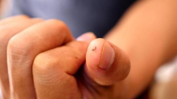 Kinh hãi món ăn từ ấu trùng bọ xít của người Ma Rốc-3