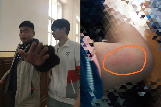 Đoàn làm phim của Hồ Nhất Thiên bị tố cáo bạo hành nữ sinh-1