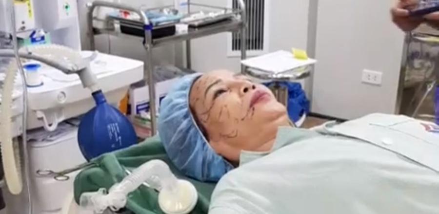 Top 3 cuộc phẫu thuật thẩm mỹ đổi đời gây xôn xao mạng xã hội năm 2018-9