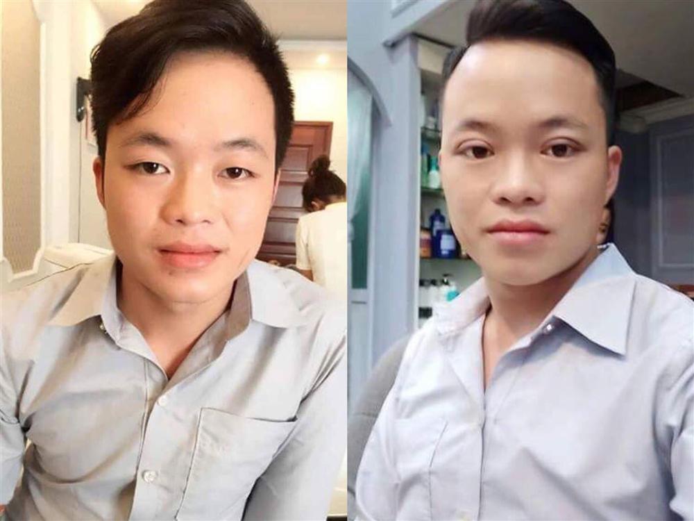 Top 3 cuộc phẫu thuật thẩm mỹ đổi đời gây xôn xao mạng xã hội năm 2018-11