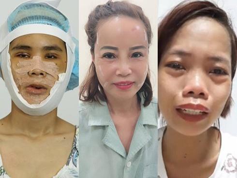 Top 3 cuộc phẫu thuật thẩm mỹ đổi đời gây xôn xao mạng xã hội năm 2018