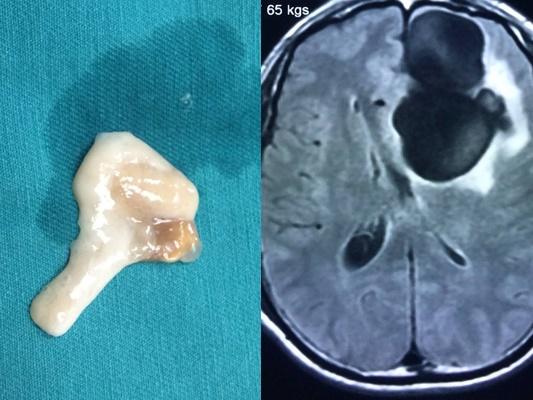 Người đàn ông suy đa tạng sau khi ăn món nhiều người yêu thích-2