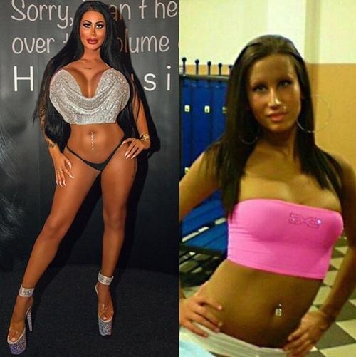 Phẫu thuật vòng 1 to vượt mặt, cô gái không thể lái xe vì sợ kẹt vô lăng-1