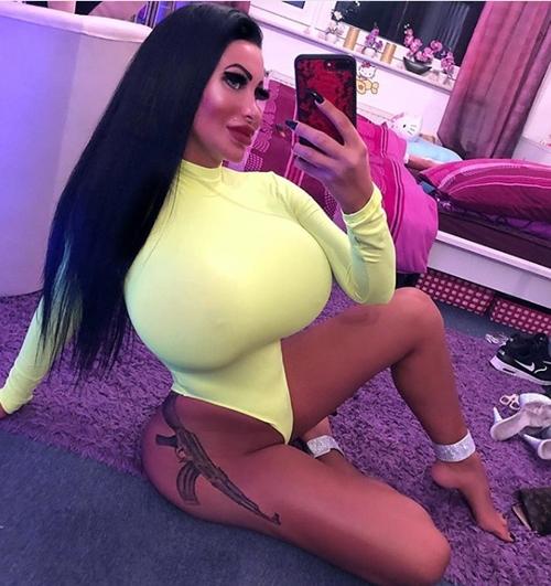 Phẫu thuật vòng 1 to vượt mặt, cô gái không thể lái xe vì sợ kẹt vô lăng-4