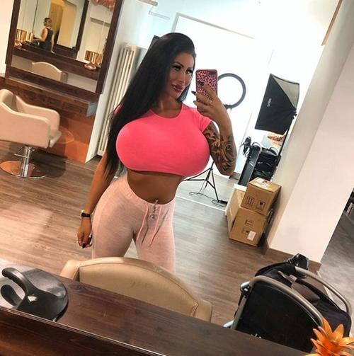 Phẫu thuật vòng 1 to vượt mặt, cô gái không thể lái xe vì sợ kẹt vô lăng-5