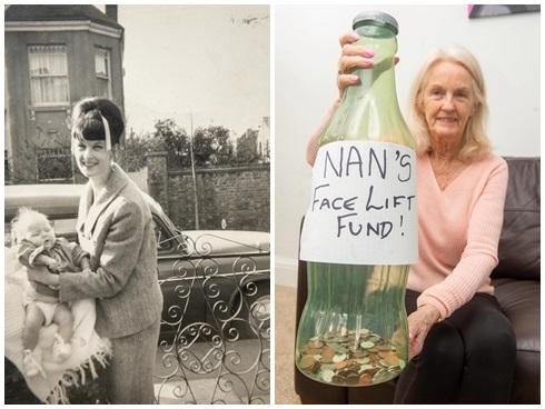 80 tuổi vẫn muốn nâng mặt để trông đẹp hơn trong quan tài