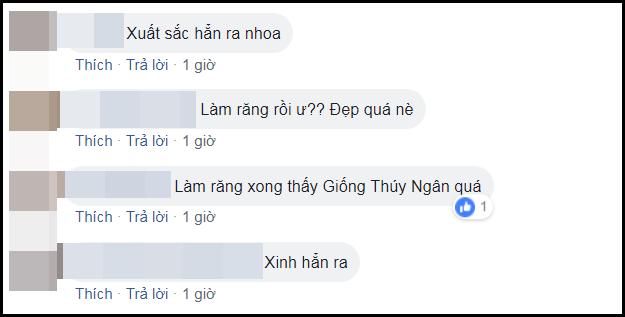 Sửa hàng tiền đạo trước khi thi quốc tế, người kế vị Hương Giang được khen đẹp xuất sắc-11