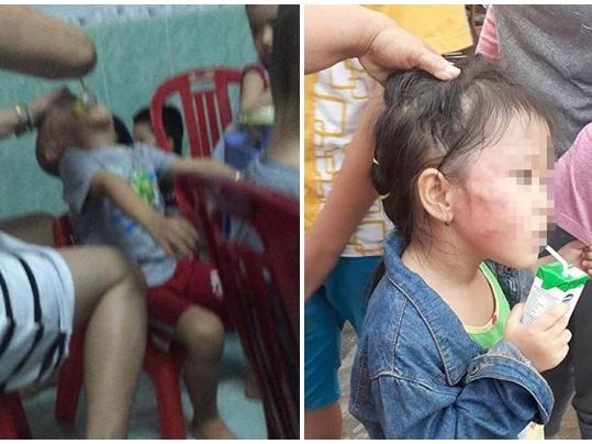 Bé gái 8 tuổi bị cha ruột đánh bầm tím khắp người-3