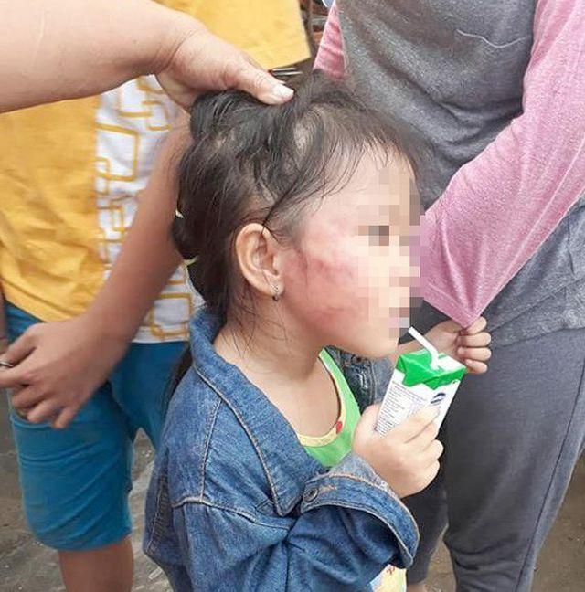 Những vụ bạo hành trẻ mầm non xôn xao dư luận năm 2018-2