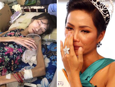 Hiếm gặp: Bé gái 7 tuổi bị u nang buồng trứng-2