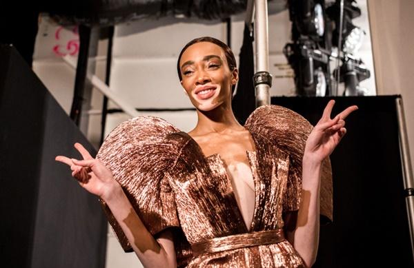 Người mẫu bạch tạng từng tham gia Victorias Secret Show sẽ diễn cho NTK Công Trí tại New York Fashion Week-2