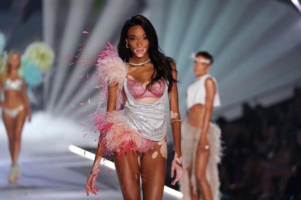 Người mẫu bạch tạng từng tham gia Victorias Secret Show sẽ diễn cho NTK Công Trí tại New York Fashion Week-1