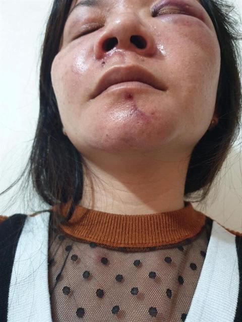 Tranh nhau ngủ với con, chồng đánh vợ thừa sống thiếu chết-2