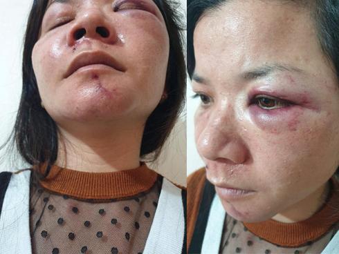 Tranh nhau ngủ với con, chồng đánh vợ thừa sống thiếu chết