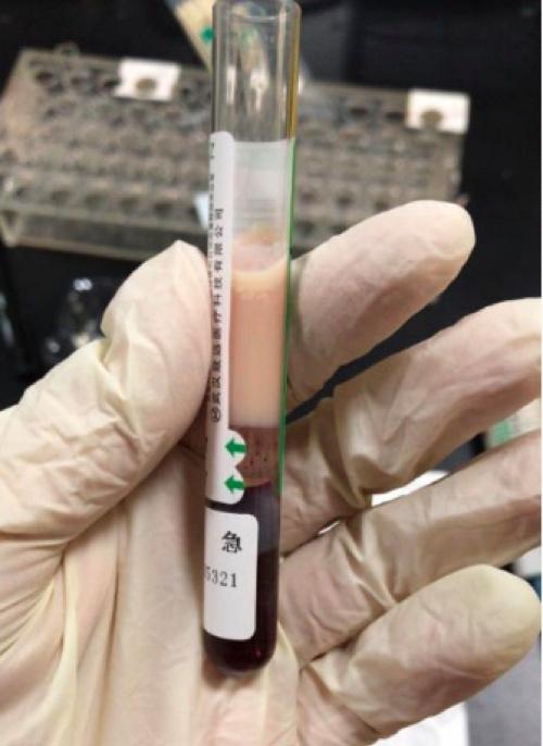 Máu của người phụ nữ trắng như sữa, vì ăn quá nhiều đồ vặt ngày Tết-2