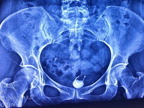 Chồng nói phải chen chân đi mua vàng nhưng tôi bất ngờ nhìn thấy anh đi ra từ nhà nghỉ-2