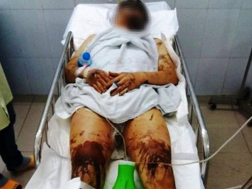 Sởn da gà với màn đánh ghen bằng axit kinh hoàng nhất màn ảnh Việt-7