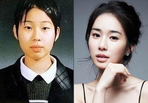 Mỹ nhân Yoo In Na tiết lộ từng bị bắt nạt hồi đi học vì ngoại hình xấu xí-1
