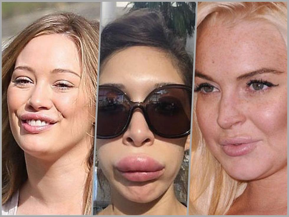 Sức mạnh của nghệ thuật trang điểm: biến người phụ nữ bị hỏng da mặt trở nên quý phái-2